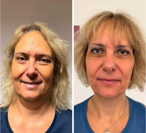 Avant puis après, une adhérente de Healthy nutrition Labège vue de face